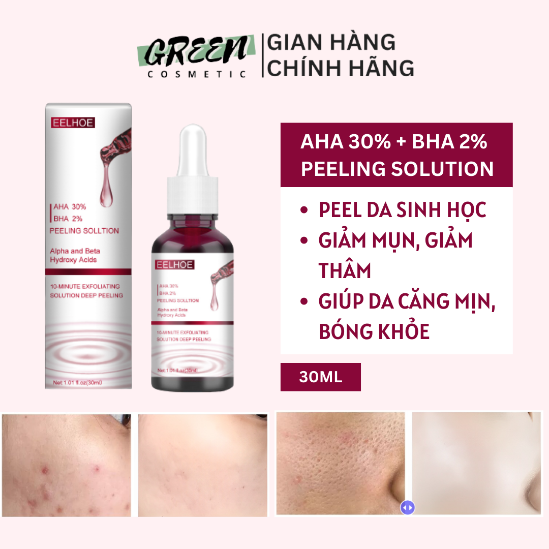 Tẩy tế bào chết serum tẩy da chết eelhoe aha 30% + bha 2% peeling solution 30ml loại bỏ các tế bào chết sâu dưới da làm sạch sâu giúp thông thoáng lỗ chân lông sạch mụn giảm các vết thâm nám