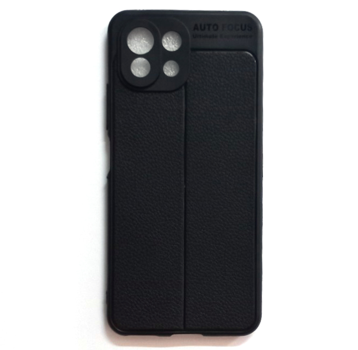 Ốp lưng dẻo xiaomi mi 11 lite / xiaomi 11 lite 5g ne