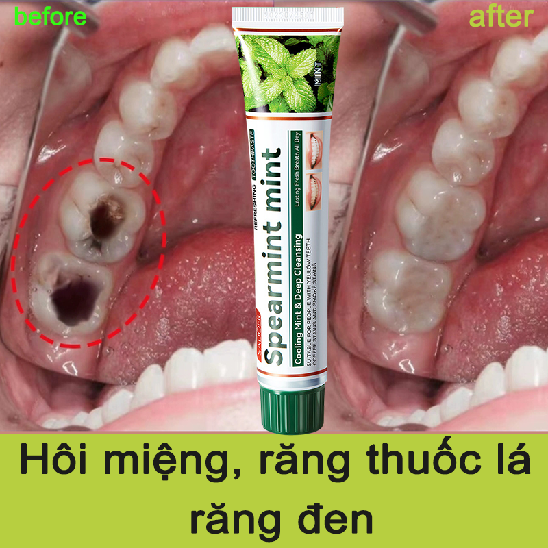 Bảo vệ răng chắc khỏe Kem Đánh Răng Dạng Gel Vệ Sinh Răng Miệng Khử Mùi Hôi Miệng Loại Bỏ Vi Khuẩn Mảng Bảm Trên Răng Cho Hàm Răng Trắng Sáng Thơm Mát