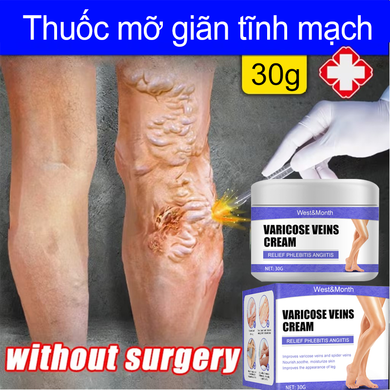 Kem giãn tĩnh mạch Kem Giảm Suy Giãn Tĩnh Mạch Kem sửa chữa giãn tĩnh mạc,Kem giãn tĩnh mạch, chăm sóc giãn tĩnh mạch, giãn tĩnh mạch chi dưới, tụ máu,Loại bỏ sự nặng nề sưng tấy ở các vùng da bị giãn tĩnh mạch 30g