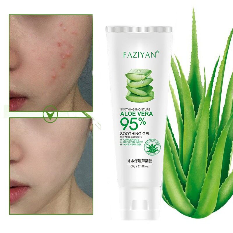 Gel lô hội dưỡng ẩm sau khi chống nắng Kem dưỡng da lô hội tự nhiên Lô hội