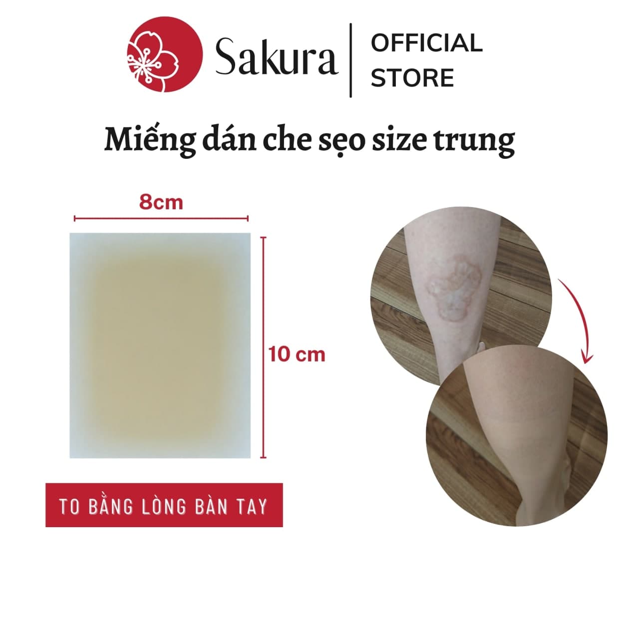 Miếng che sẹo Nhật bản Sakura 8x10cm che khuyết điểm sẹo thâm sẹo lồi sẹo lõm, chất liệu silicon tự nhiên chống nước, an toàn cho da