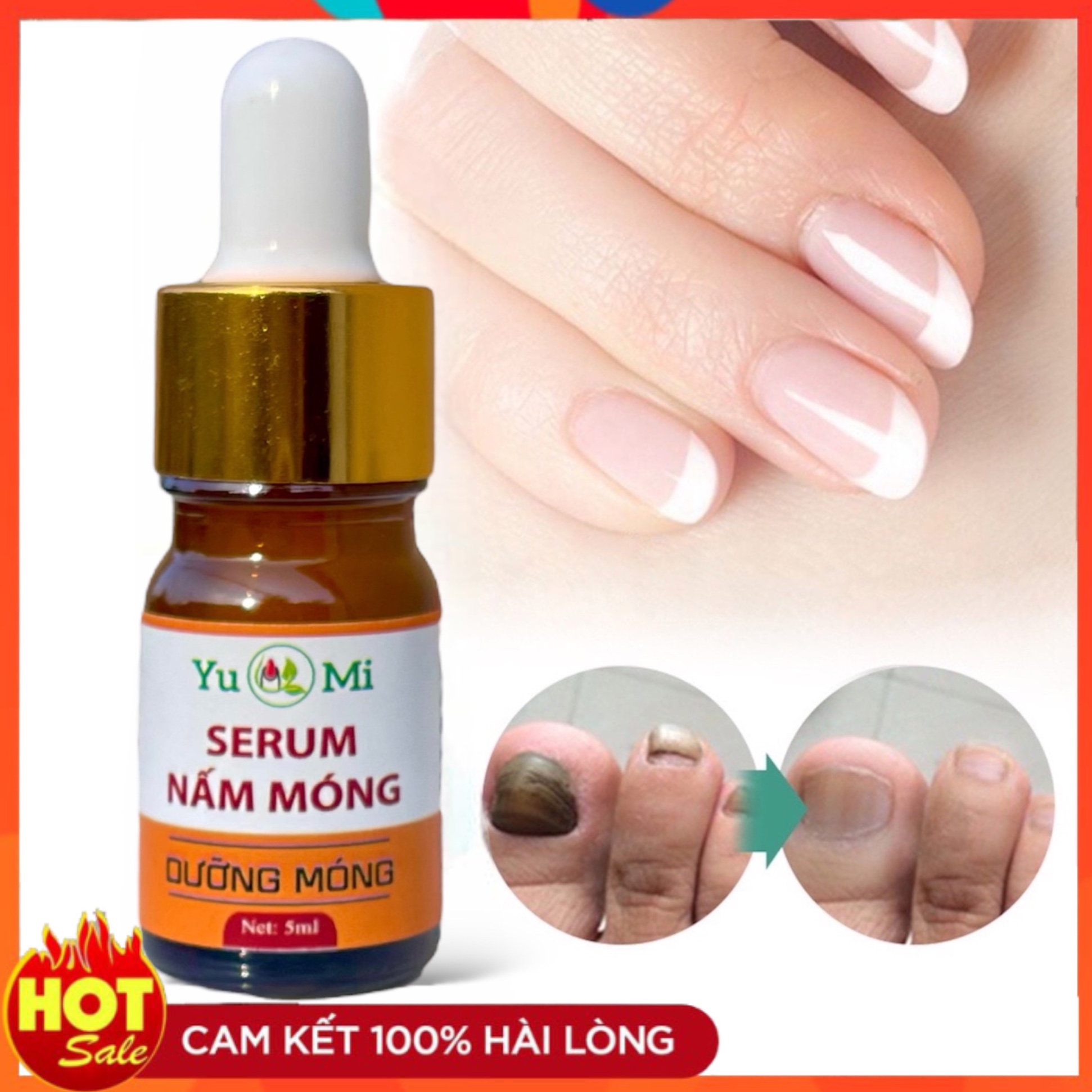 Serum nấm móng tay chân, đánh bay nấm móng, bọng móng, hư khoé, nước ăn tay chân,dưỡng cứng móng, dai móng