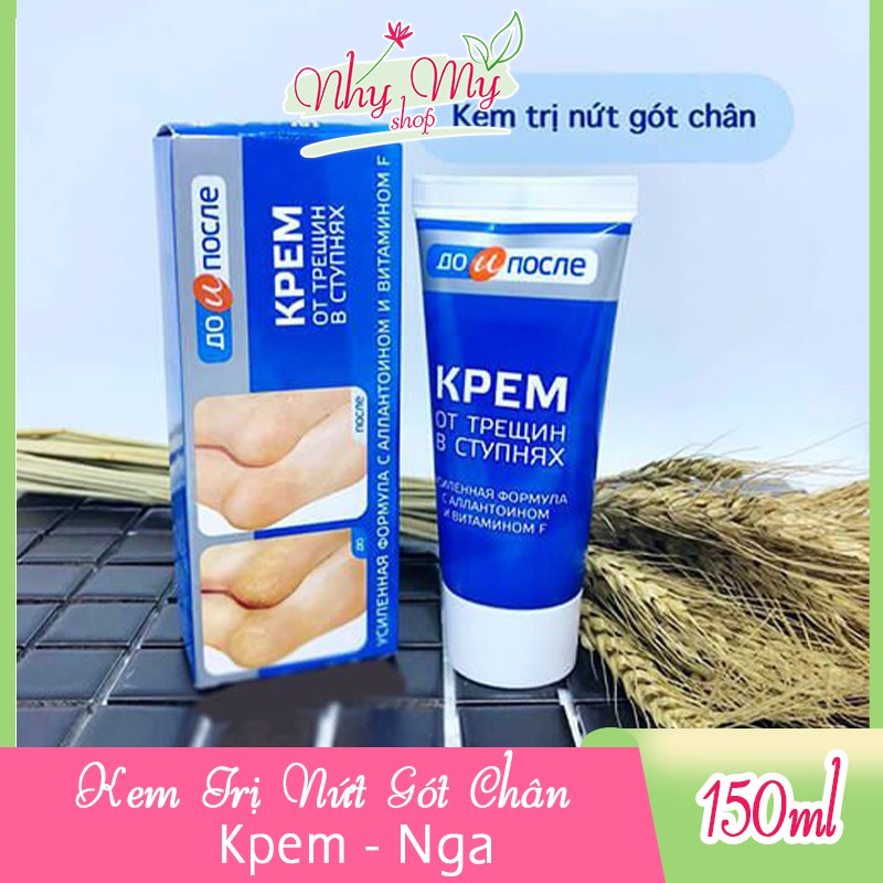 Kem nứt nẻ gót chân kpem (tuýp), sản phẩm tốt với chất lượng, độ bền cao và được cam kết sản phẩm y như hình