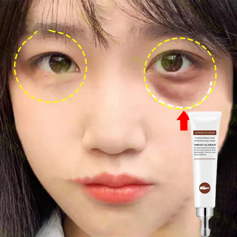 Kem dưỡng mắt, Kem dưỡng ẩm chống lão hóa vùng mắt, làm săn chắc và làm dịu da mắt, giảm nếp nhăn, dưỡng ẩm cho vùng da nhạy cảm quanh vùng mắt, huyết thanh dưỡng ẩm