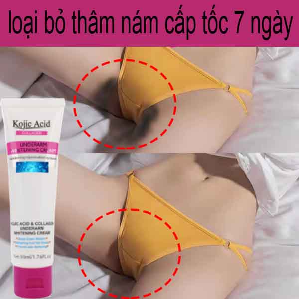 Kem dưỡng trắng da vùng nách, kem dưỡng ẩm làm trắng da vùng dưới cánh tay và kem dưỡng trắng da toàn thân. Làm trắng và khử mùi vùng nách, trị thâm nách và đầu gối, vùng kín. (Làm trắng nhanh trong 7 ngày)