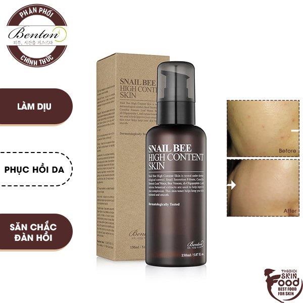 ✧℗ Nước Hoa Hồng Phục Hồi Làm Dịu Da Benton Snail Bee High Content Skin 150ml