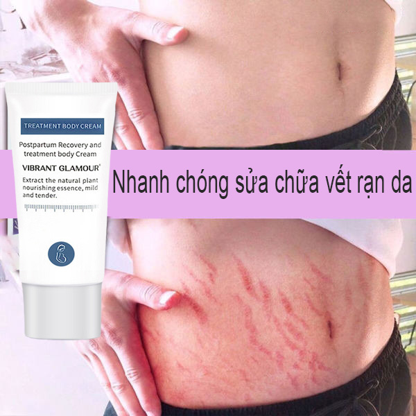 Kem Làm Mờ Vết Rạn Da, Kem Xóa Sẹo, xóa sẹo cơ thể, sẹo mụn, vết tàn nhang, vết rạn da, kem xóa sẹo làm mờ vết rạn da.
