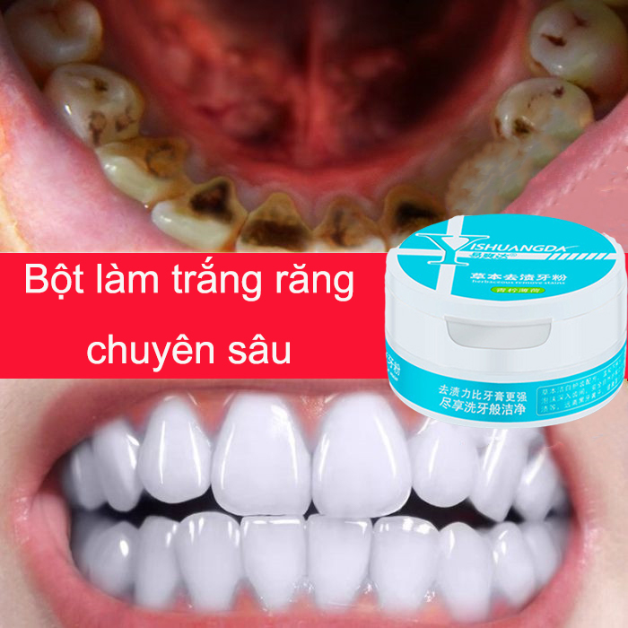 Bột đánh răng, baking soda,làm sáng răngchất làm trắng răng bảo vệ men răng – chăm sóc răng miệng – kem đánh răng cao cấp 50g，Powerful Stain Removal Toothpowder