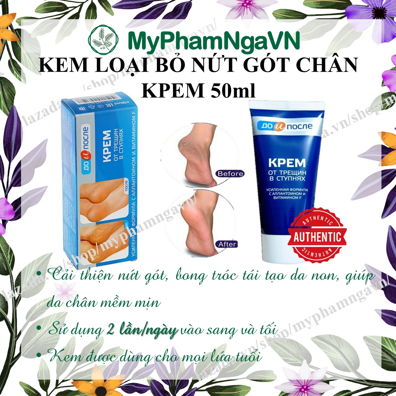 [HCM]Kem Chống Nứt Gót Chân Kpem Cream For Carcks In The Feet 50ml