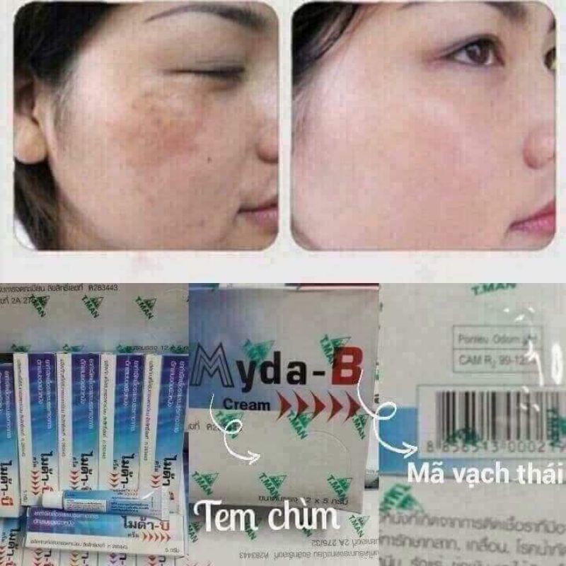 Myda b sỉ 1 hộp 12 tuýp kem nám myda - b 15g chuẩn thái lan