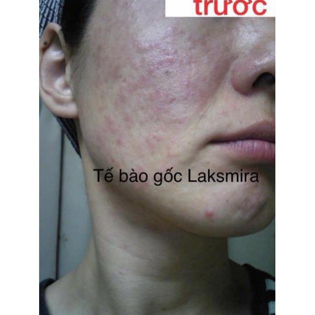 vCSzd9vO95TzdD1GDzrh_simg_d0daf0_800x1200_max.jpg