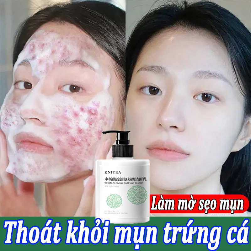 Sữa rửa mặt kiểm soát dầu cho phụ nữ tạo Sữa rửa mặt axit amin làm trắng da sữa rửa Kiểm soát dầu và mụn Sữa rửa mặt 500ml Loại bỏ mụn diệt ve Làm sạch sâu lỗ chân lông làm trắng kiểm soát dầu Dùng được cho cả nam và nữ