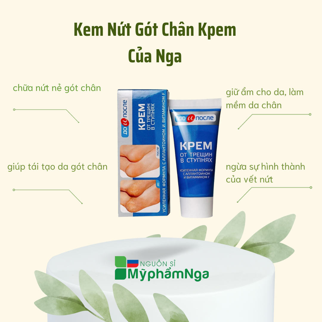 Nứt gót chân Nga Kpem dưỡng ẩm làm mềm gót chân