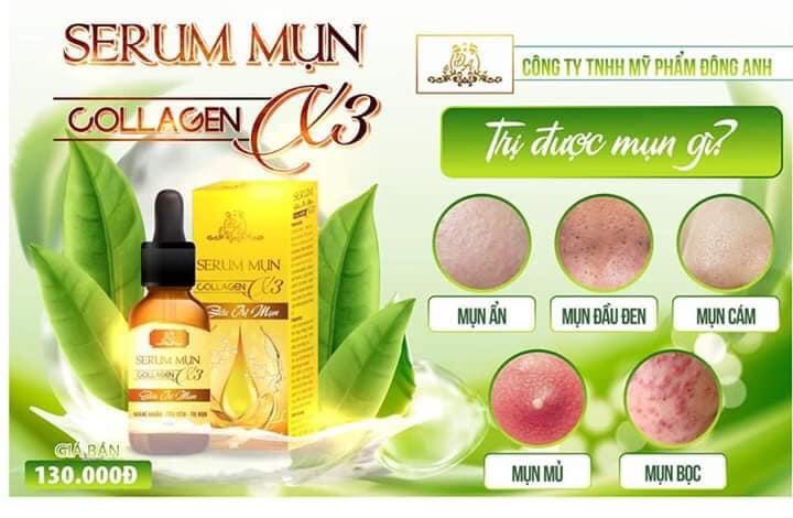 Serum mụn collagen X3 siêu tr mụn