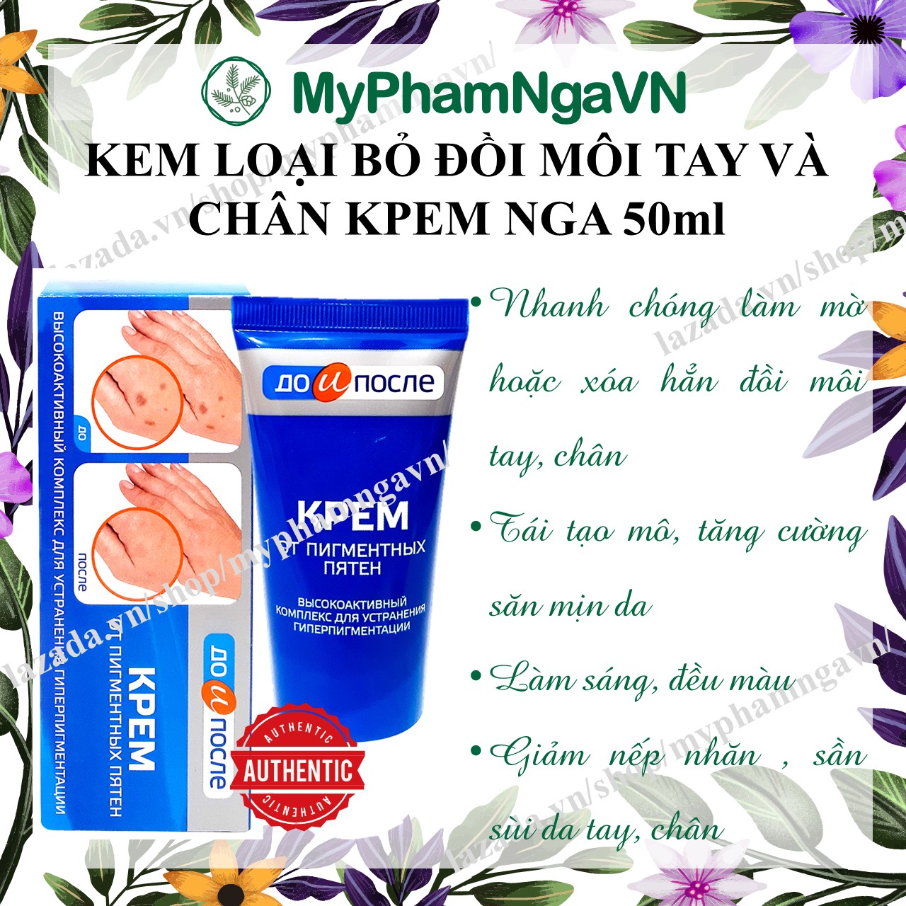 Kem loại bỏ đồi mồi da tay chân kpem 50ml