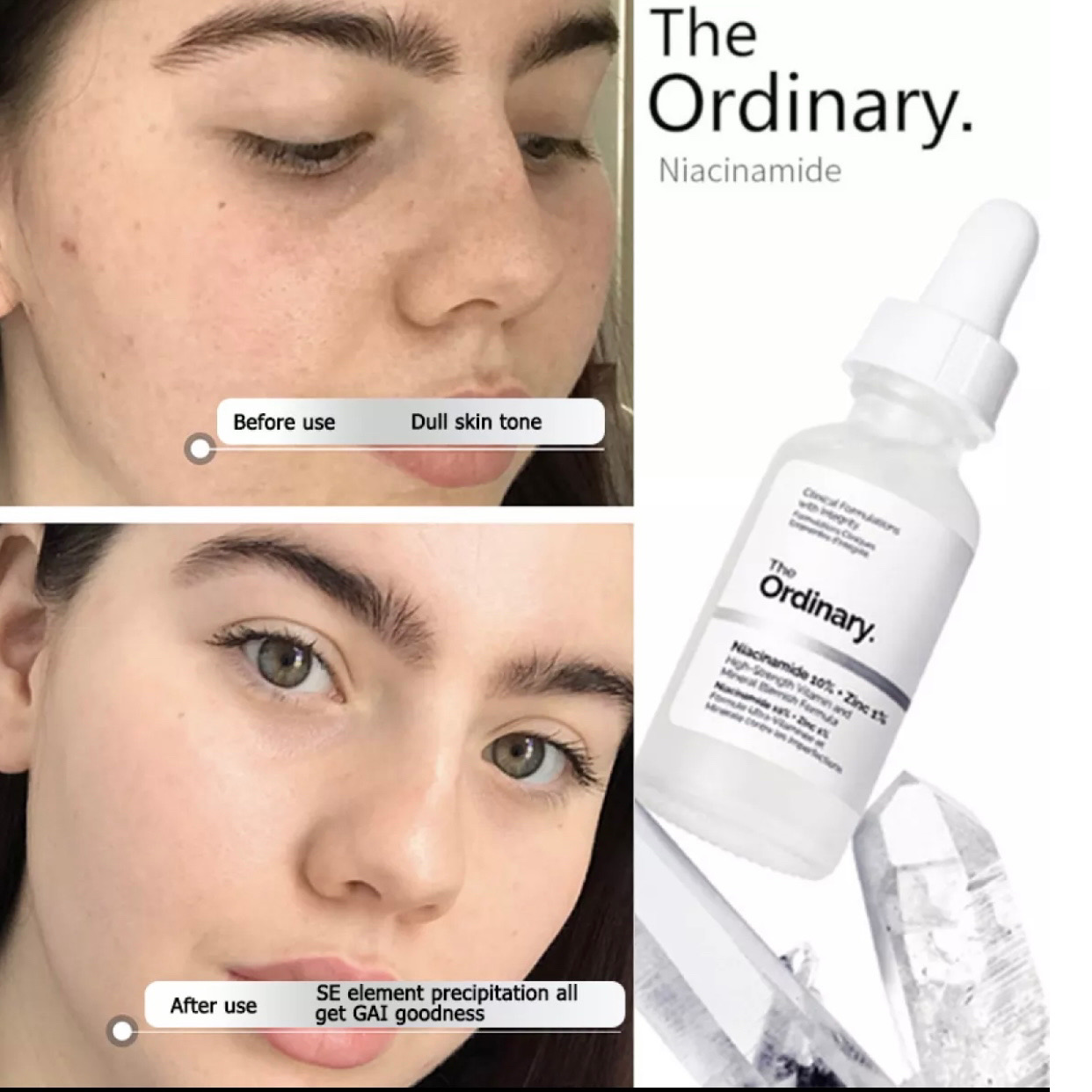 [HCM]The Ordinary Niacinamide 10% + Zinc 1% 30ML Face Serum Oil Balance Reduce Skin Blemishes Whitening