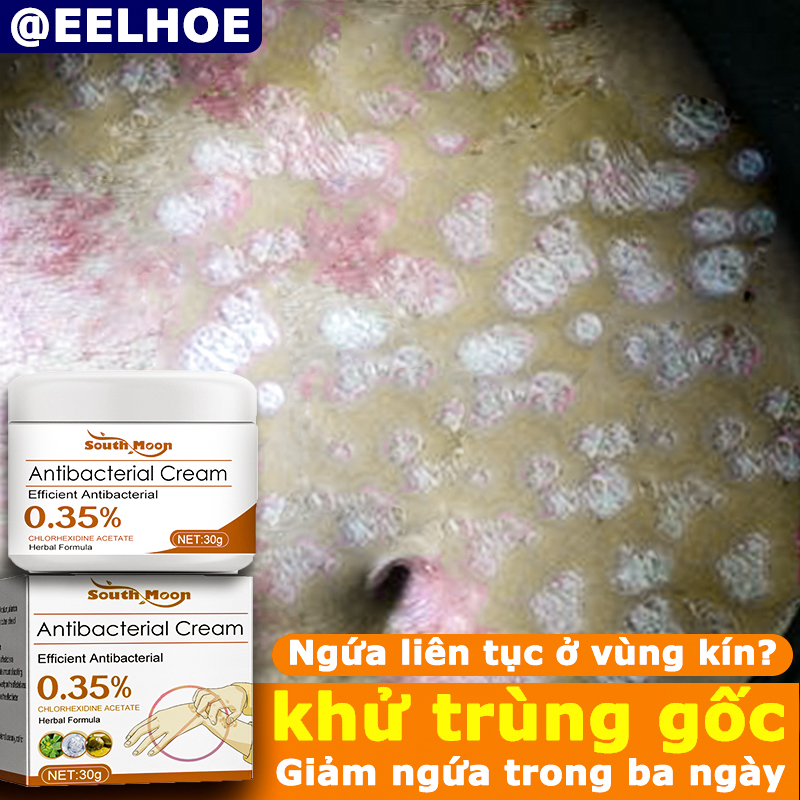 7 ngày khỏi hoàn toàn，Chỉ quân đội,nấm da đầu,Kem bôi vẩy nến,Giải quyết nhiễm nấm,nấm,viêm da cơ địa,nấm da,mẩn ngứa,á sừng,mề đay ,kem bôi hắc lào nấm ngứa,kem trị nấm ngứa da,hắc lào,thuốc bôi ngoài da ngứa,kem bôi viêm da cơ địa