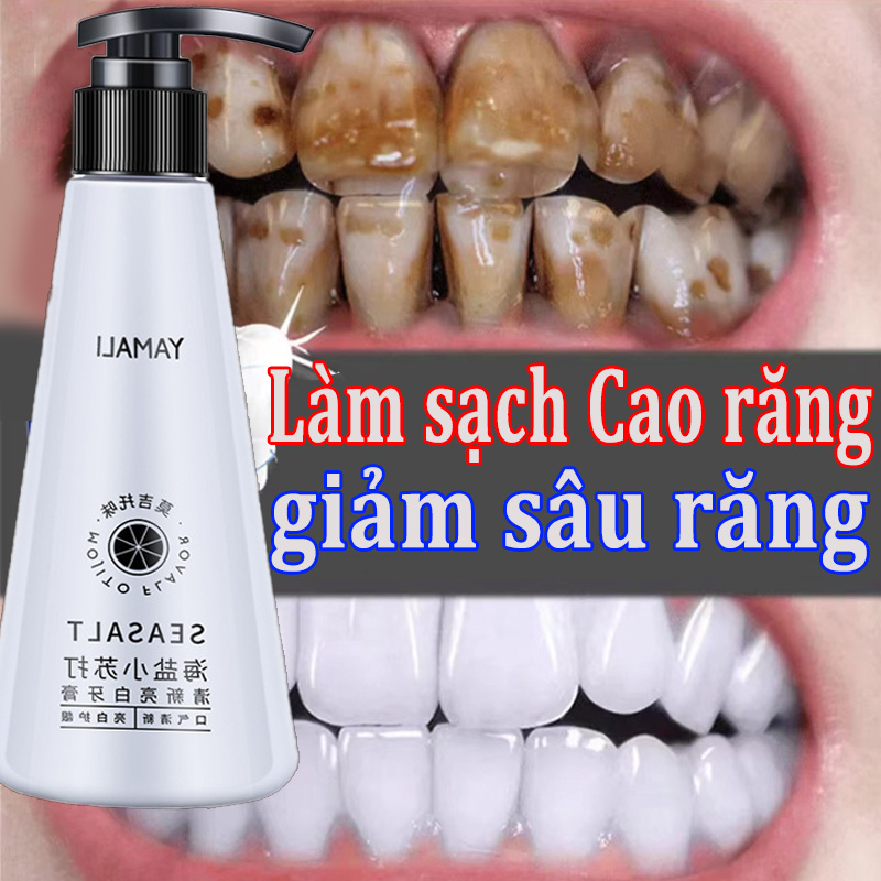 Kem đánh răng, kem đánh răng làm trắng, làm trắng răng kem đánh răng baking soda Kem đánh răng làm trắng răng 200g loại bỏ cao răng khử mùi hôi ức chế vi khuẩn đánh tan vết ố răng Giảm sưng nướu răng,giảm sâu răng