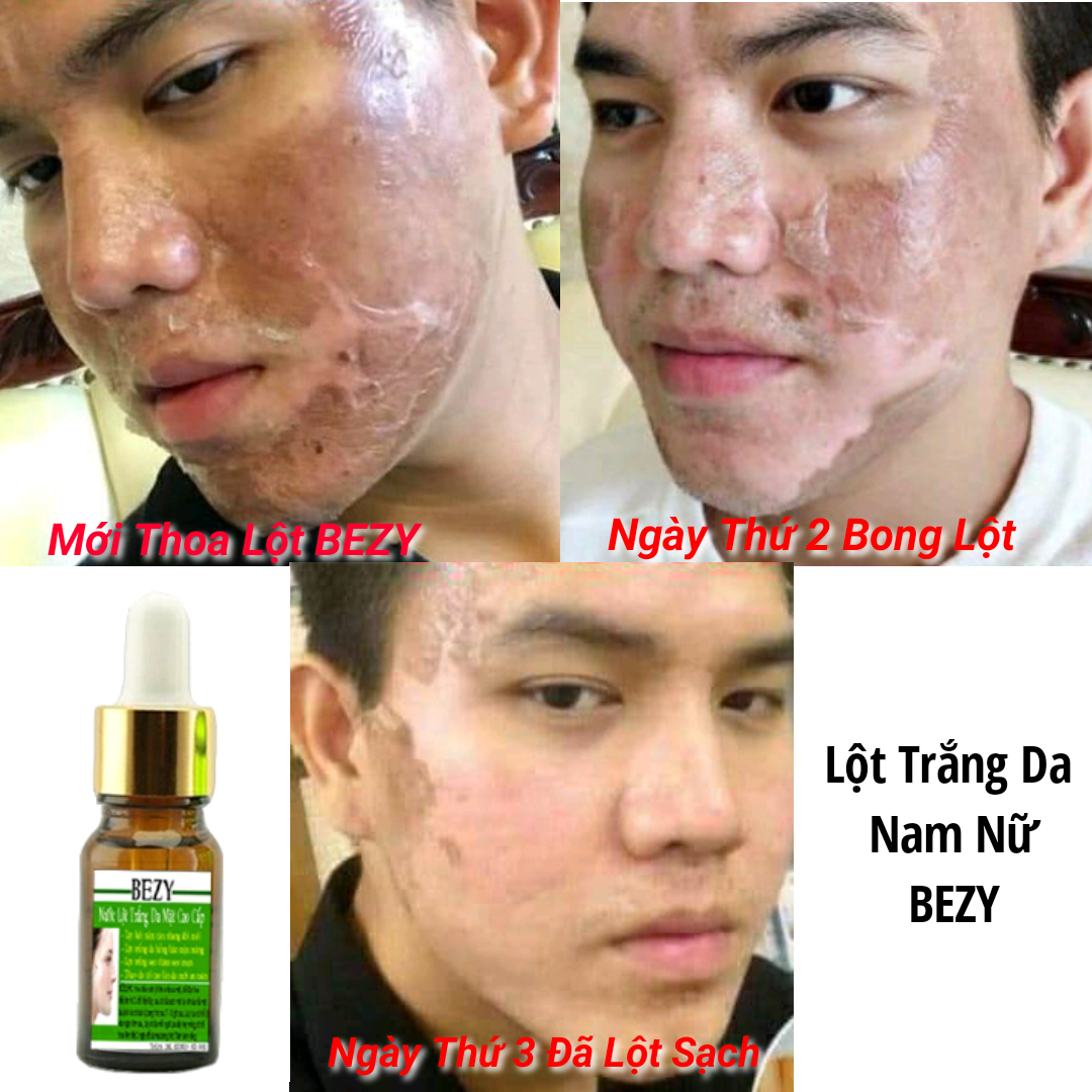 [FREESHIP] Lột Thay Da Sinh Học Trắng Da Hết Nám Sạm BEZY Thái Lan (MACOIZY SHOP)