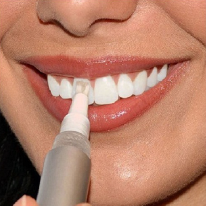 Bút Tẩy Trắng Răng Siêu Tốc Cao Cấp Dazzling