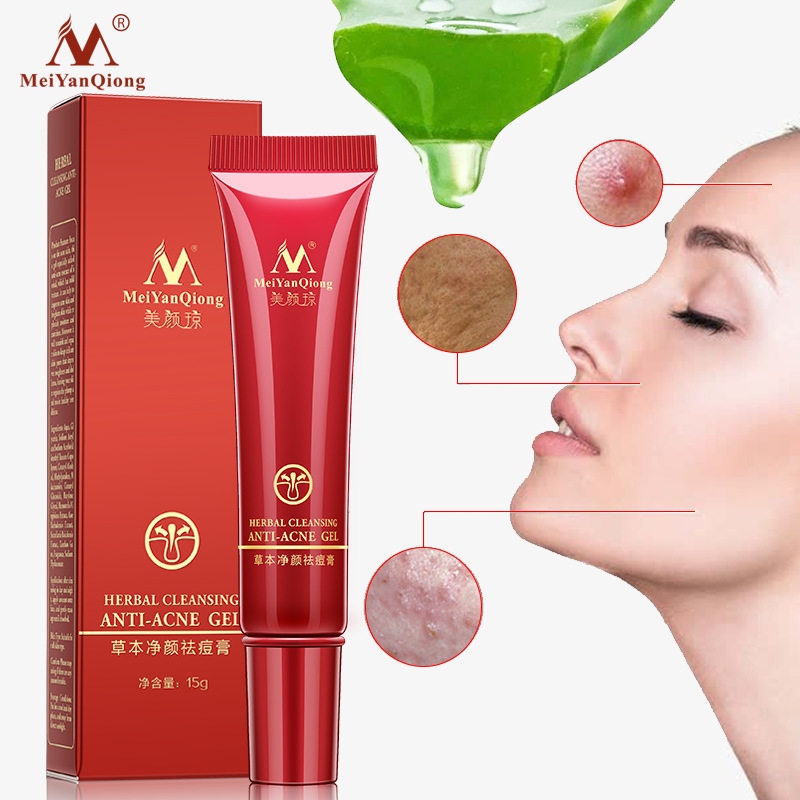 【CW】 Effective Acne Removal Herbal Anti Repair Fade Spots Oil Control Whitening Moisturizing Face Gel 15g