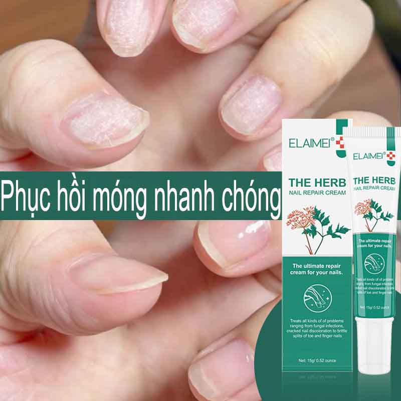 Kem Tẩy Nấm Móng, huyết Thanh Sửa Móng Tay,Gel Tẩy Nấm Chân 15g Loại Bỏ Nấm, nhanh chóng sửa chữa móng Chiết Xuất Từ Thảo Dược Thiên Nhiên, Tinh chất dưỡng móng tay và móng chân loại bỏ nấm nhiễm trùng giúp móng chắc khoẻ, bọng móng