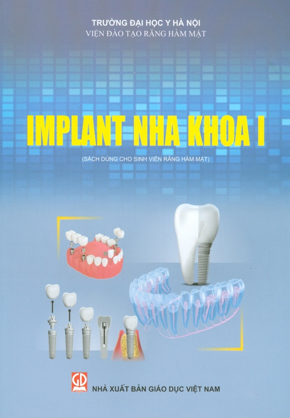 Implant Nha Khoa I