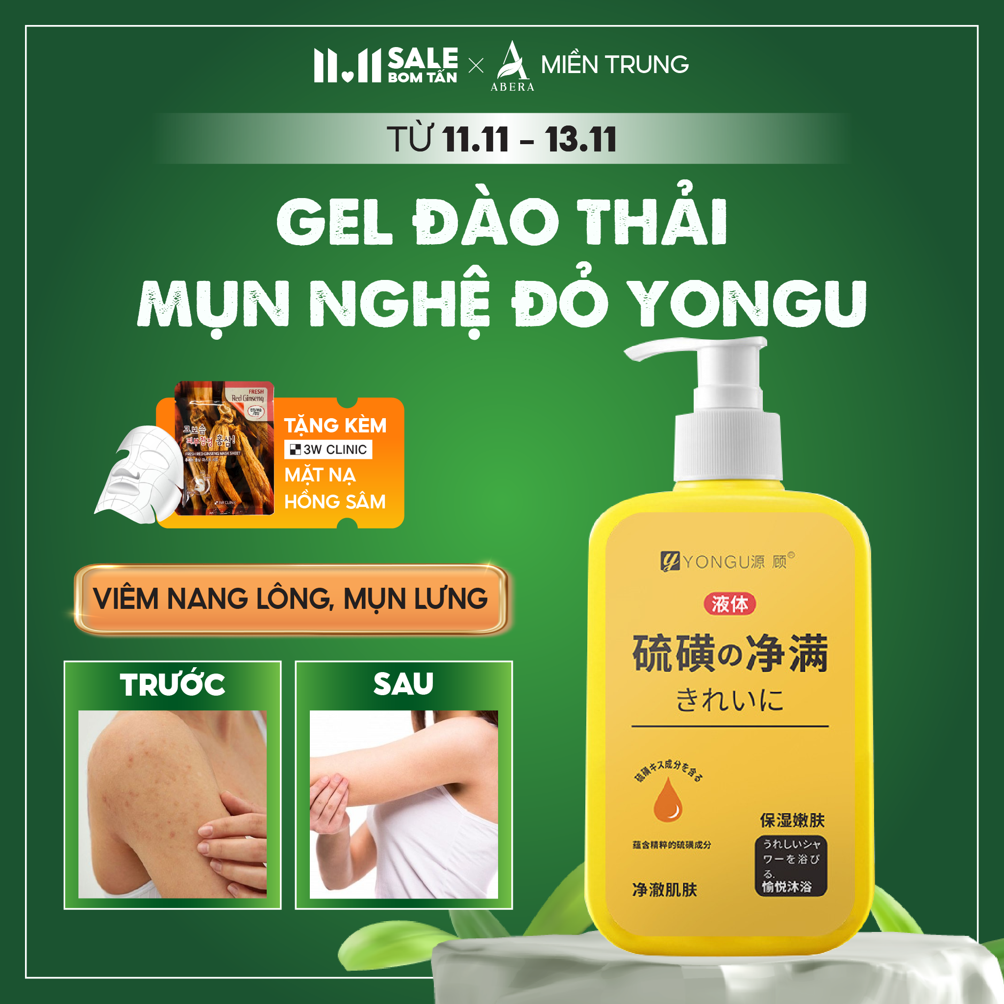 Gel thải mụn lưng cơ thể, mụn lưng nam, mụn lưng cho nữ, viêm nang lông, gel đào thải mụn nghệ đỏ YONGU - Không để lại thâm, không bị tái lại