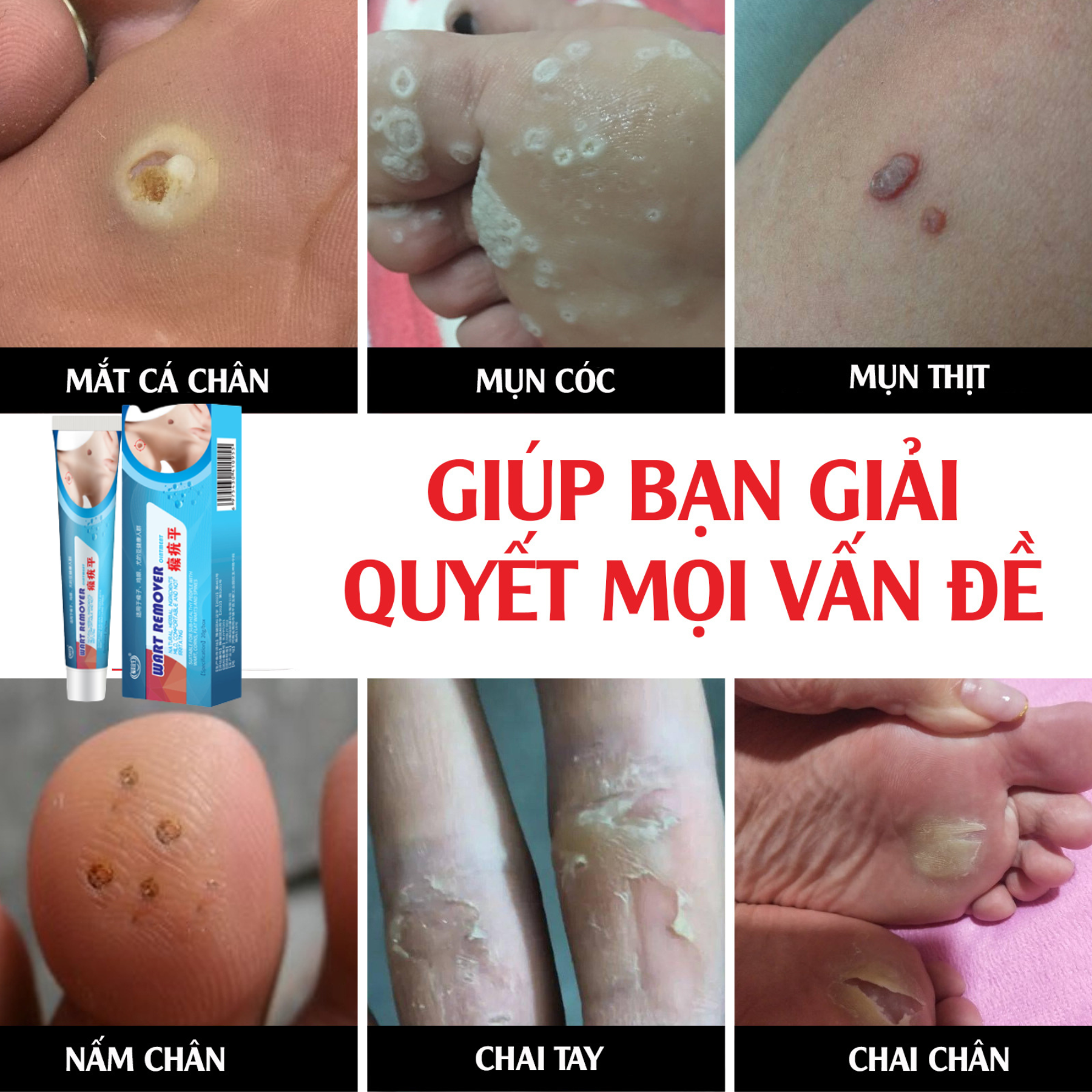 Kem liquid want flat kem giảm mụn cấp tốc hết mụn mờ thâm mờ mụn cóc mờ nốt ruồi liền sẹo tái tạo trắng da mặt