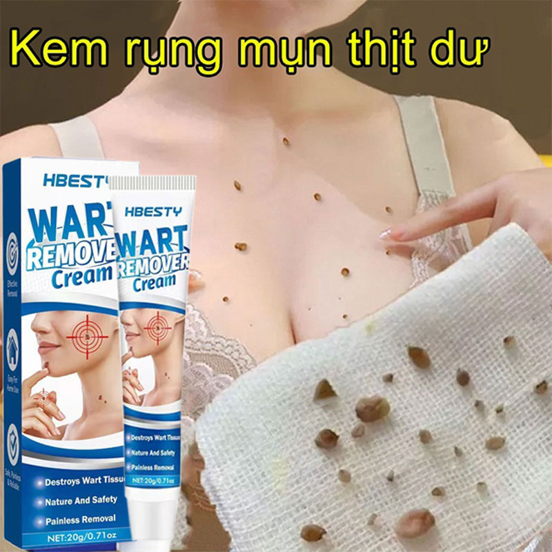 100% Chính Hãng | kem xoá mụn cóc | mụn thịt , loại bỏ mụn cóc thông thường ,mụn đá , mụn cơm ,mụn cóc dạng sợi | loại bỏ mụn cóc nhanh chóng Loại bỏ mụn cóc an toàn và không đau