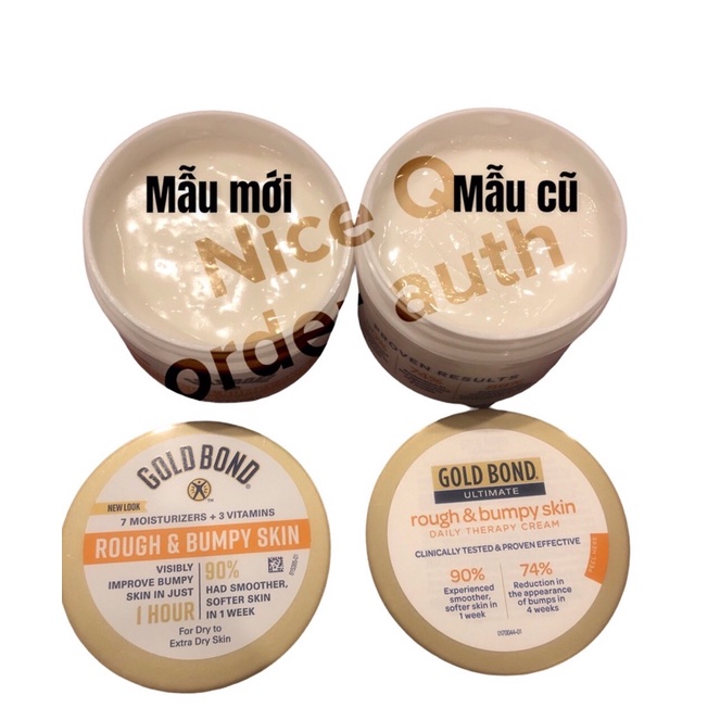 Kem dưỡng body Gold Bond 226gr cho da thâm, sần sùi