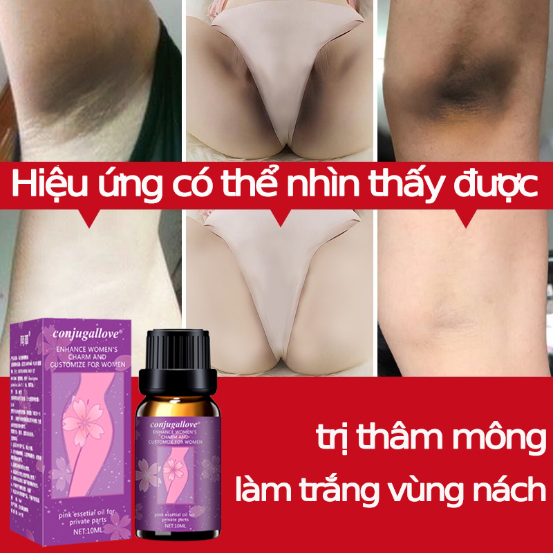 Trị thâm mông kem trị thâm làm trắng vùng nách,khử mùi hôi vùng nách,trị thâm vùng kín,đầu gối,khuỷu tay chân10ml