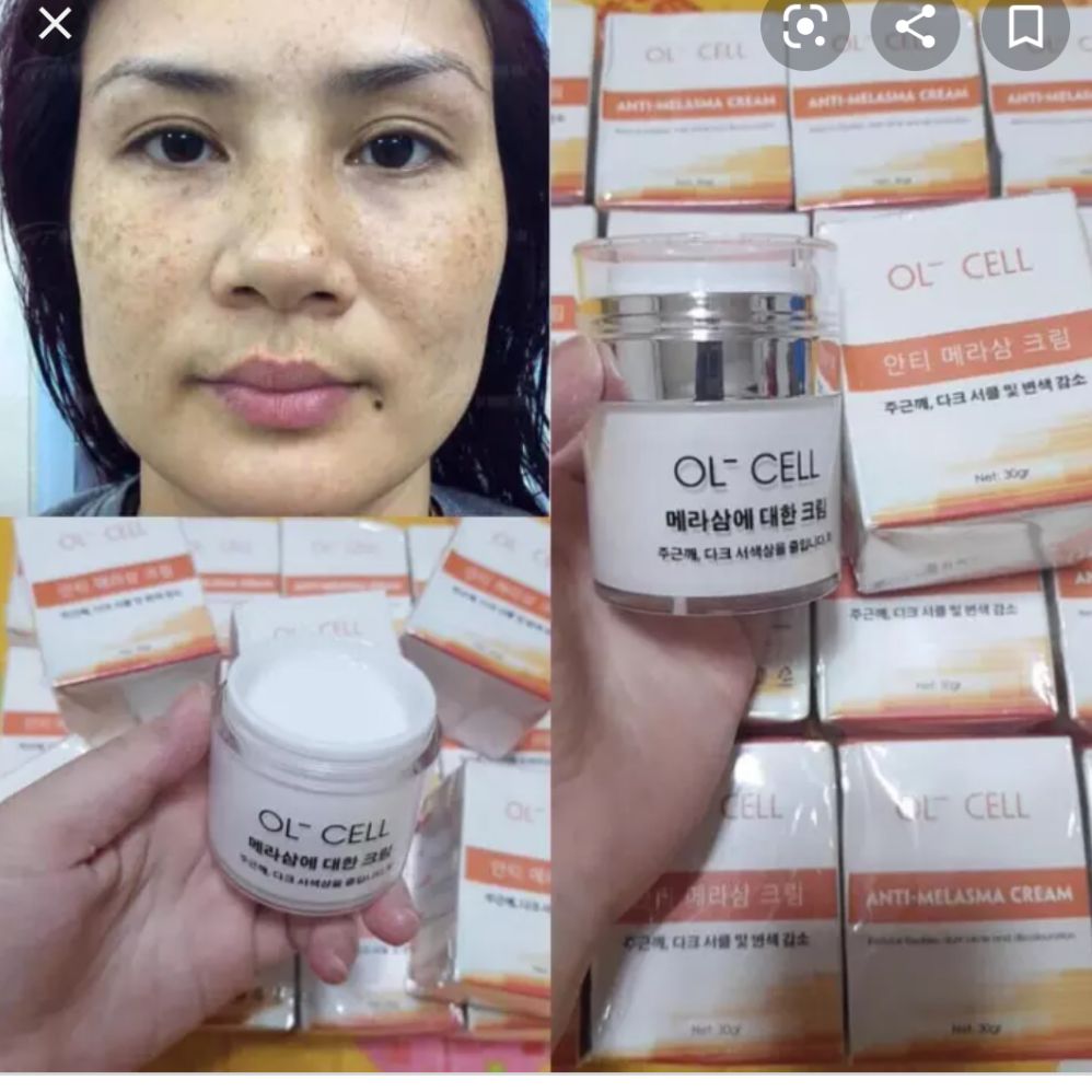 kem hút nám OL CELL