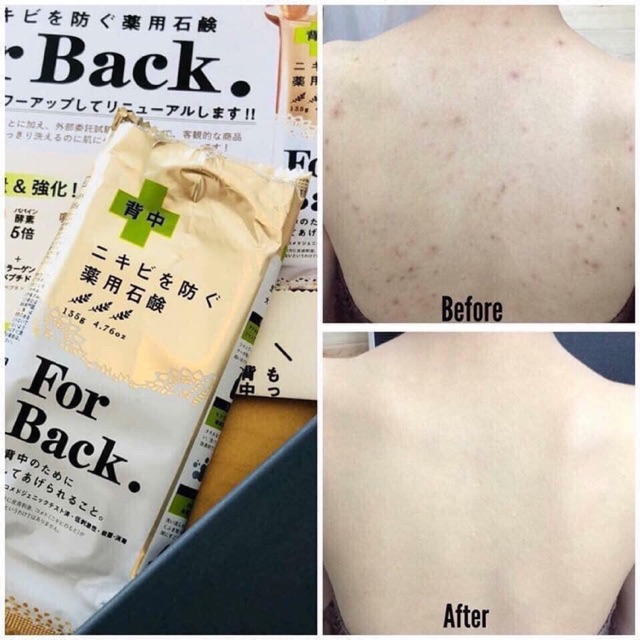 Xà Phòng Mụn Lưng For Back Nhật Bản 135g mụn lưng mụn cánh tay xà phòng rửa mặt Pelican