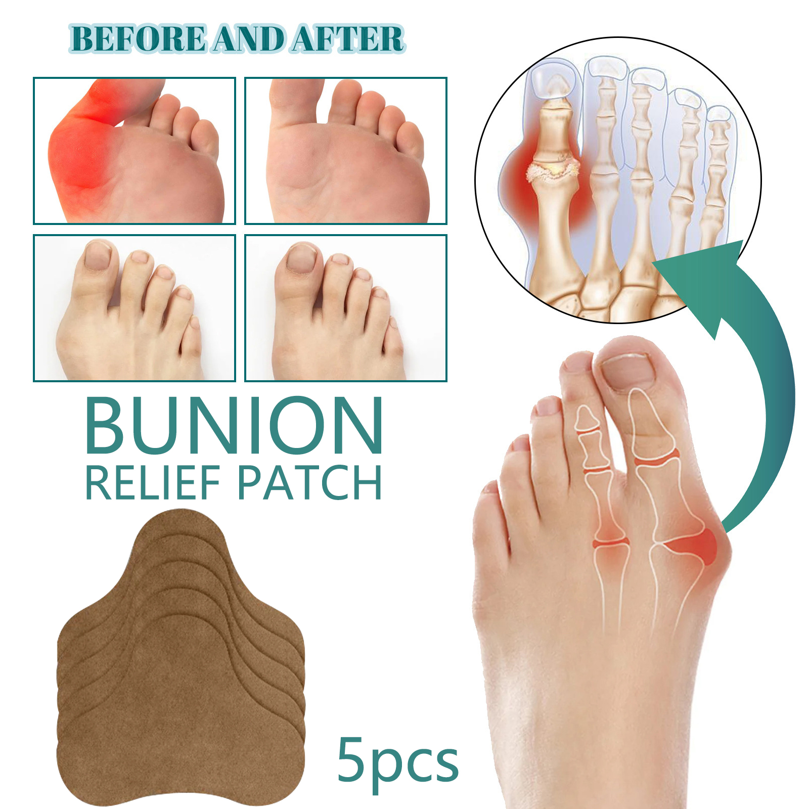 5pcs Correction nursing care of thumb capsule correction patch to relieve foot thumb valgus swelling, joint pain and discomfort