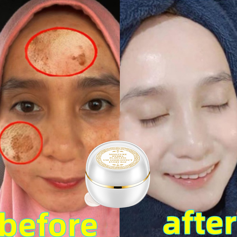 Kem xóa tàn nhang đồi mồi Kem Làm trắng Hot sale giảm giá Kem trắng da và xóa tàn nhang 30g Nám tàn nhang hiệu quả,Làm mờ thâm nám tàn nhan,kem thâm nám tàn nhang đồi mồi,Săn chắc da kem dưỡng ẩm cho