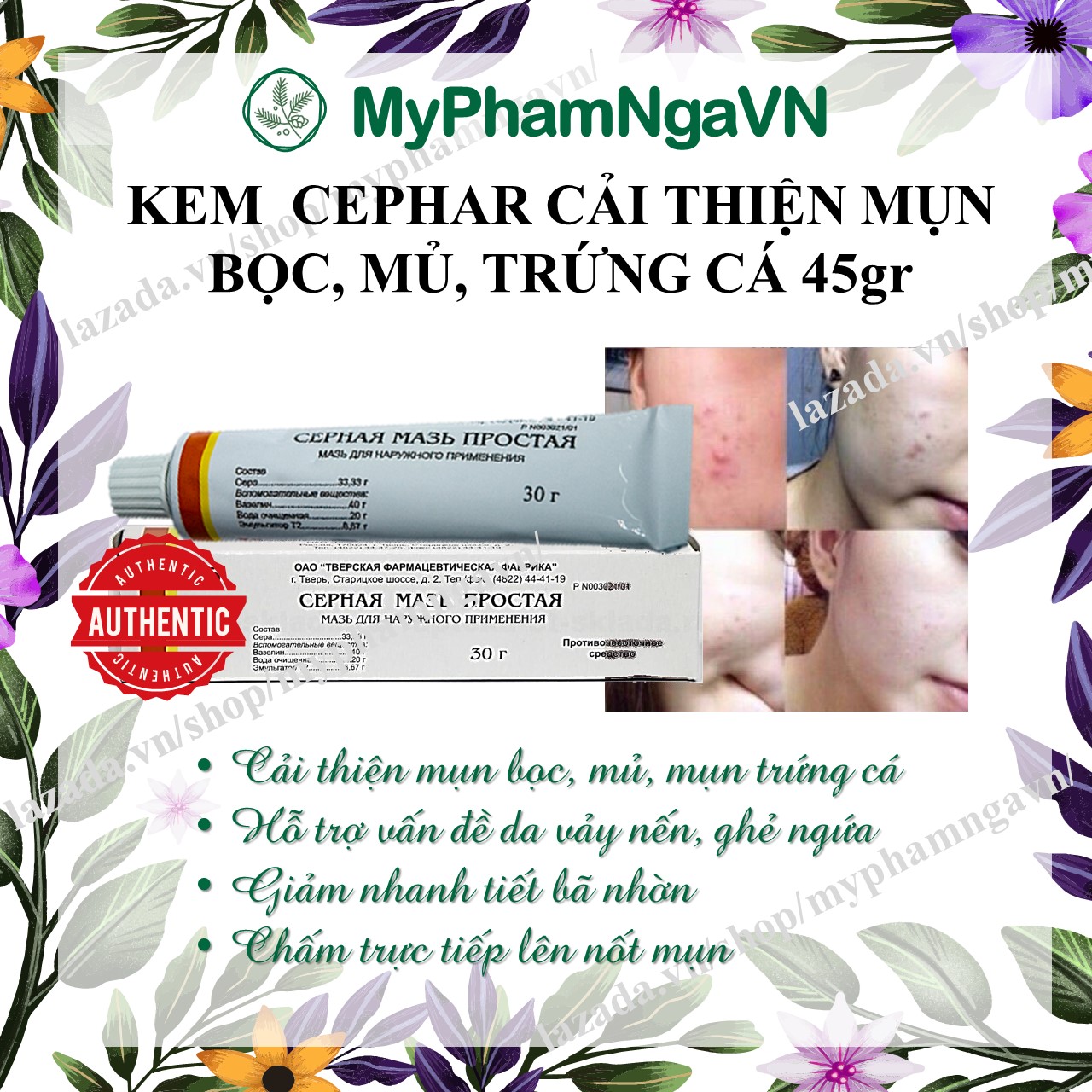Kem loại bỏ mụn lưu huỳnh cephar nga 30gr