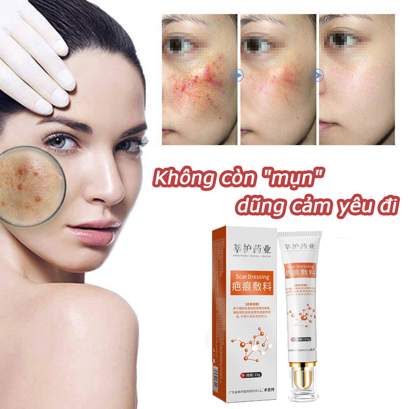 Kem trị mụn, chống mụn mạnh mẽ, loại bỏ mụn trứng cá, làm mờ vết mụn, sửa chữa vết mụn, phục hồi tổn thương, da bên, kiểm soát dầu, thu nhỏ lỗ chân lông, làm trắng, loại bỏ mụn trứng cá, dưỡng ẩm