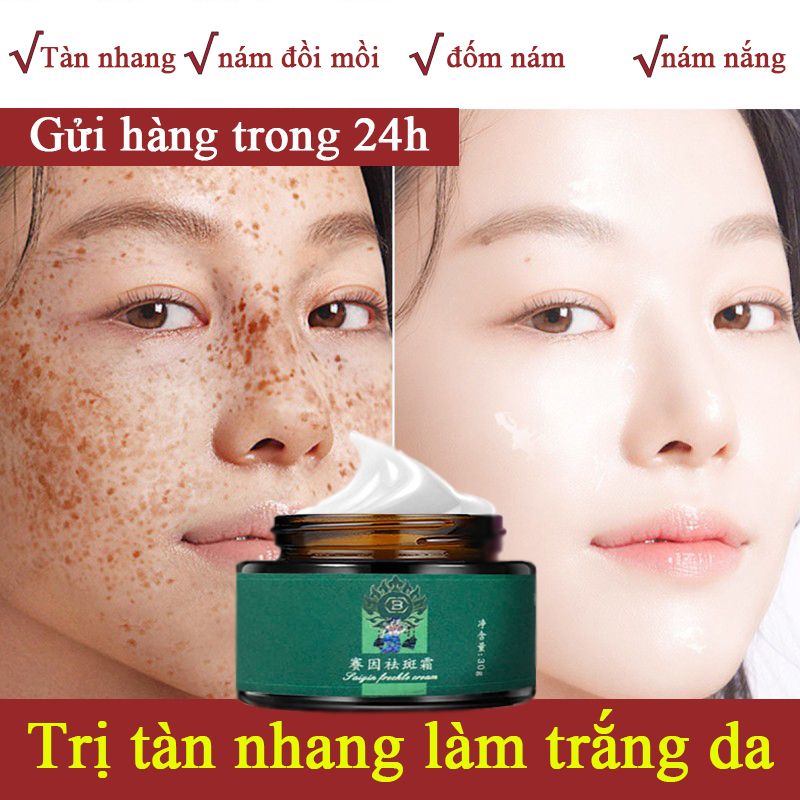 Kem xóa tàn nhang, kem làm trắng da, tinh chất làm trắng da và xóa tàn nhang, xóa vết thâm nám, tàn nhang, vết chân chim, đồi mồi, làm mờ hắc tố, làm trắng da, săn chắc da, Có sẵn cho sinh viên
