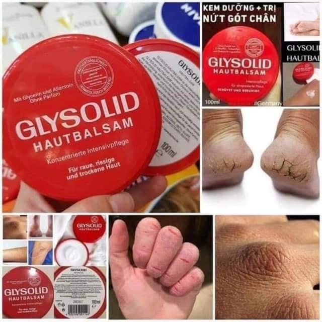 Kem dưỡng trị nứt á sừng da tay da chân glysolid đỏ hautbalsam