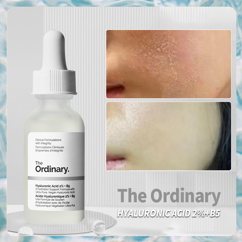 Serum the ordinary hyaluronic acid 2% + B5 chính hãng serum dưỡng ẩm