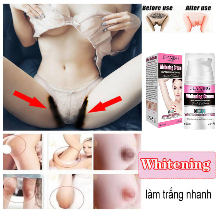 Trị thâm mông,kem trị thâm nách vùng bikini, Kem dưỡng trắng da, giảm thâm nách, khử mùi hôi, làm sáng da body . Làm trắng và khử mùi hôi nách, trị thâm nách, thâm đầu gối, khuỷu tay