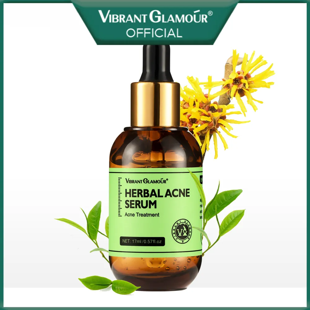 VIBRANT GLAMOUR giảm giá 15% Serum chống mụn thảo dược Giảm mụn, ngăn ngừa viêm nhiễm, cải thiện làn da 17ml