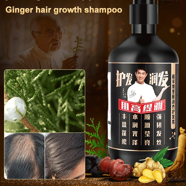 Polygonum Multiflorum And Ginger Shampoo Oil Control And Hair Loss Prevention Hair Growth Lotion