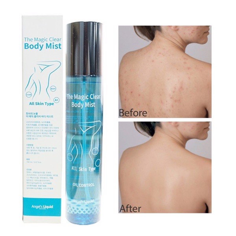 [HCM]Xịt Mụn Cơ Thể The Magic Clear Body Mist Hàn Quốc
