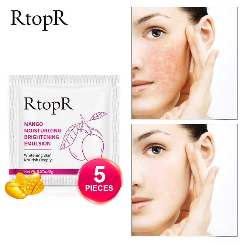 RtopR kem tinh chất xoài dưỡng ẩm làm trắng sáng chống lão hóa kèm sữa dưỡng chăm sóc kép kem dưỡng da mặt mụn hiệu quả - INTL