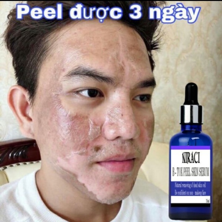 [HCM]Feel Thay da Niraci của Hàn Quốc  tái tạo da mới căng mịn