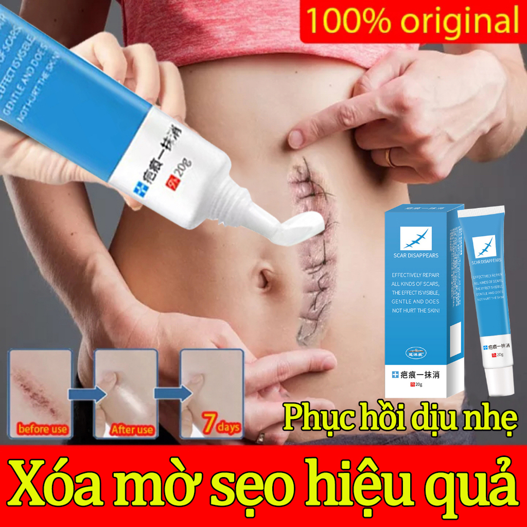 Kem che sẹo，kem xóa sẹo thâm, lấp đầy sẹo rỗ, sẹo lõm，kem mờ sẹo mờ thâm - kem giảm sẹo và rạn da,giảm rạn da hiệu quả
