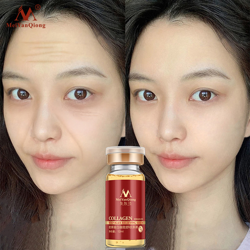 MeiYanQiong Serum tinh chất collagen giảm nếp nhăn chống lão hoá chăm sóc da mặt 12ml - INTL